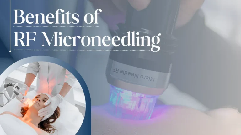 5 Benefits of RF Microneedling for Your Skin
