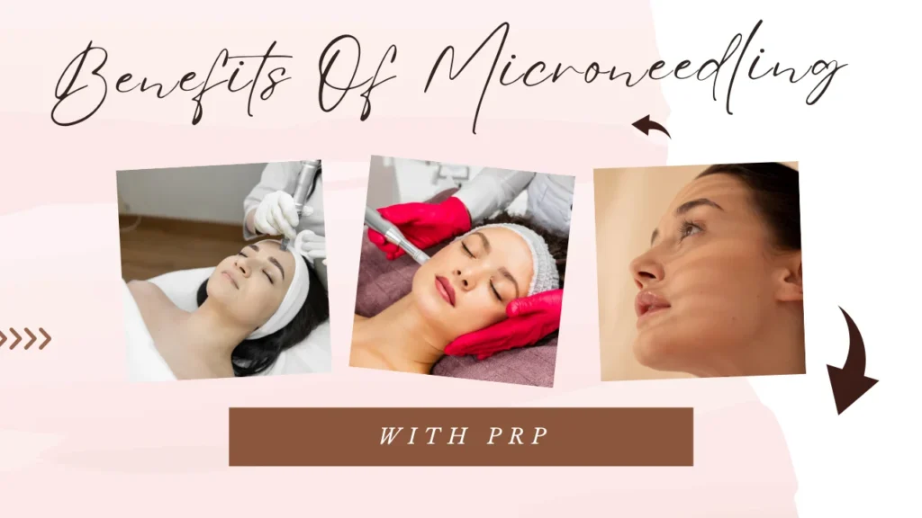 benefits of microneedling with PRP