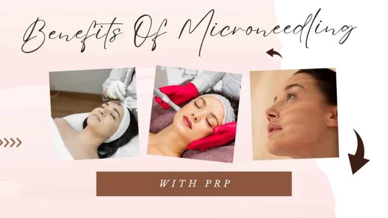 The Benefits of Microneedling with PRP