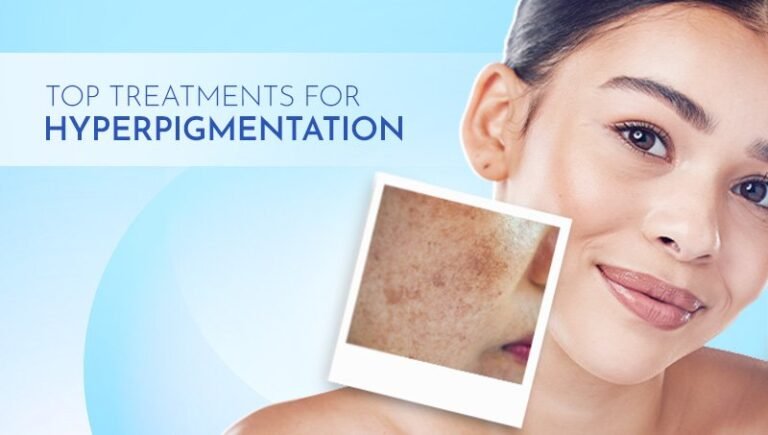 Top Treatments for Hyperpigmentation: From Serums to Professional Procedures