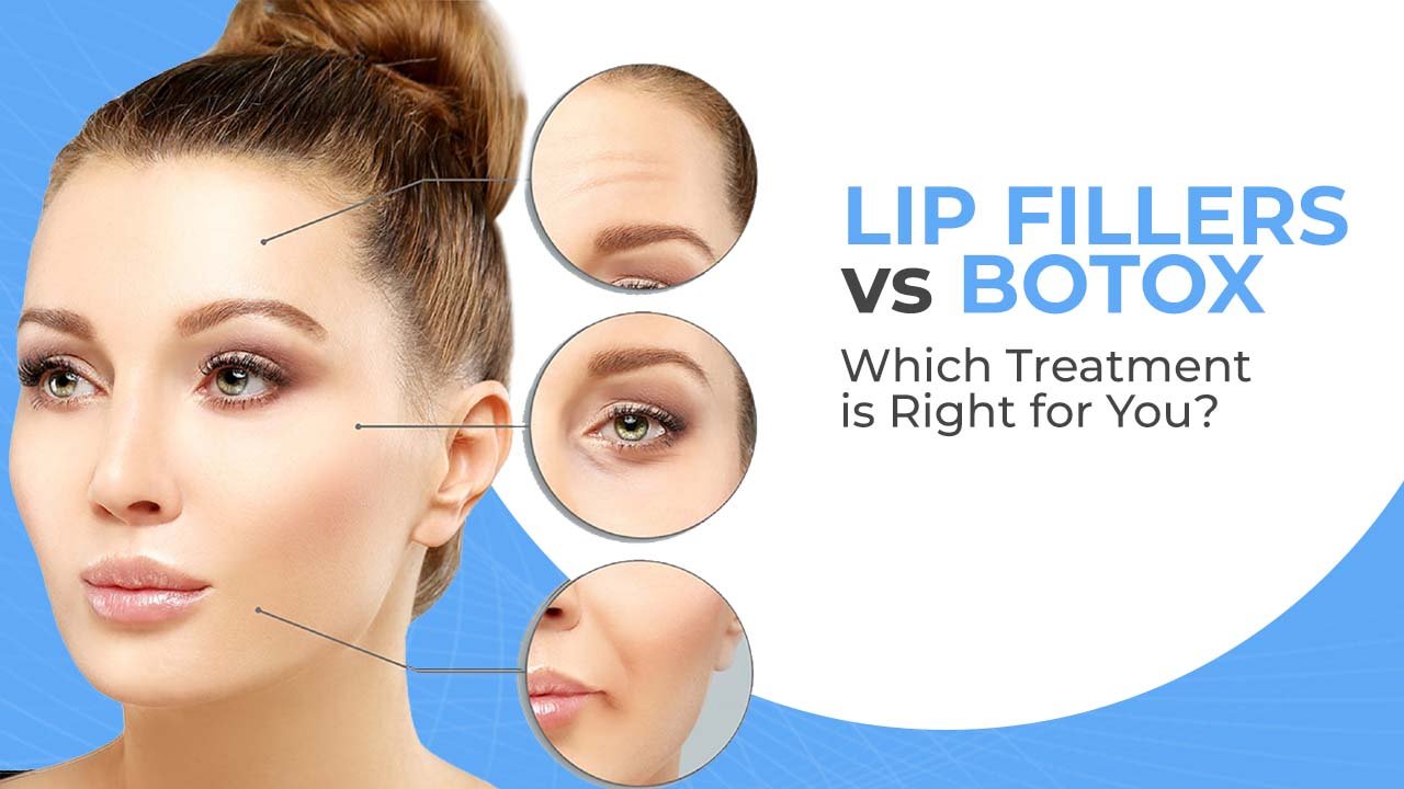 Lip Fillers Vs Botox - Doctor fehmida