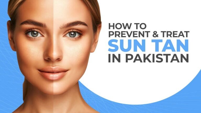 How to Prevent and Treat Sun Tan in Pakistan