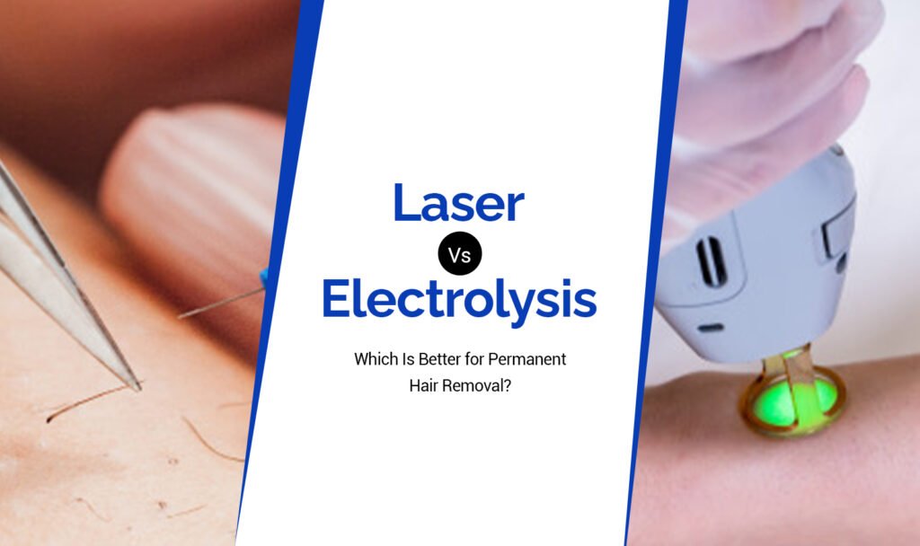 Laser vs. Electrolysis: Which Is Better for Permanent Hair Removal?