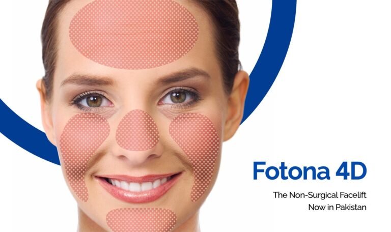 Fotona 4D Pakistan: The Non-Surgical Facelift Now in Pakistan