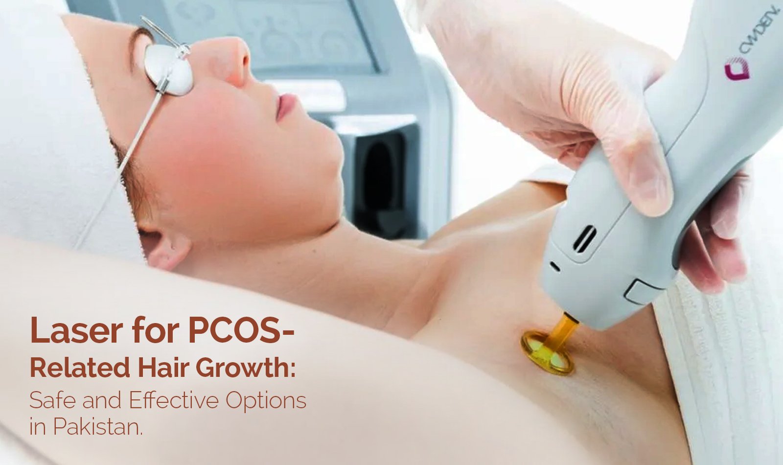 Laser for PCOS-Related Hair Growth: Safe and Effective Options in Pakistan