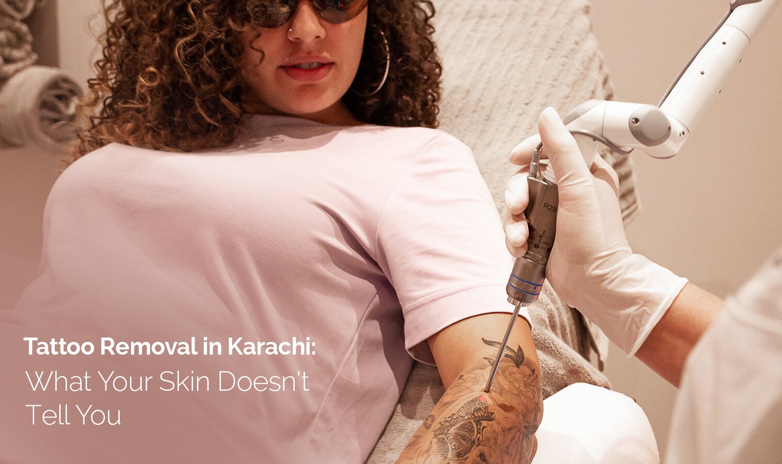 Tattoo Removal in Karachi: What Your Skin Doesn’t Tell You