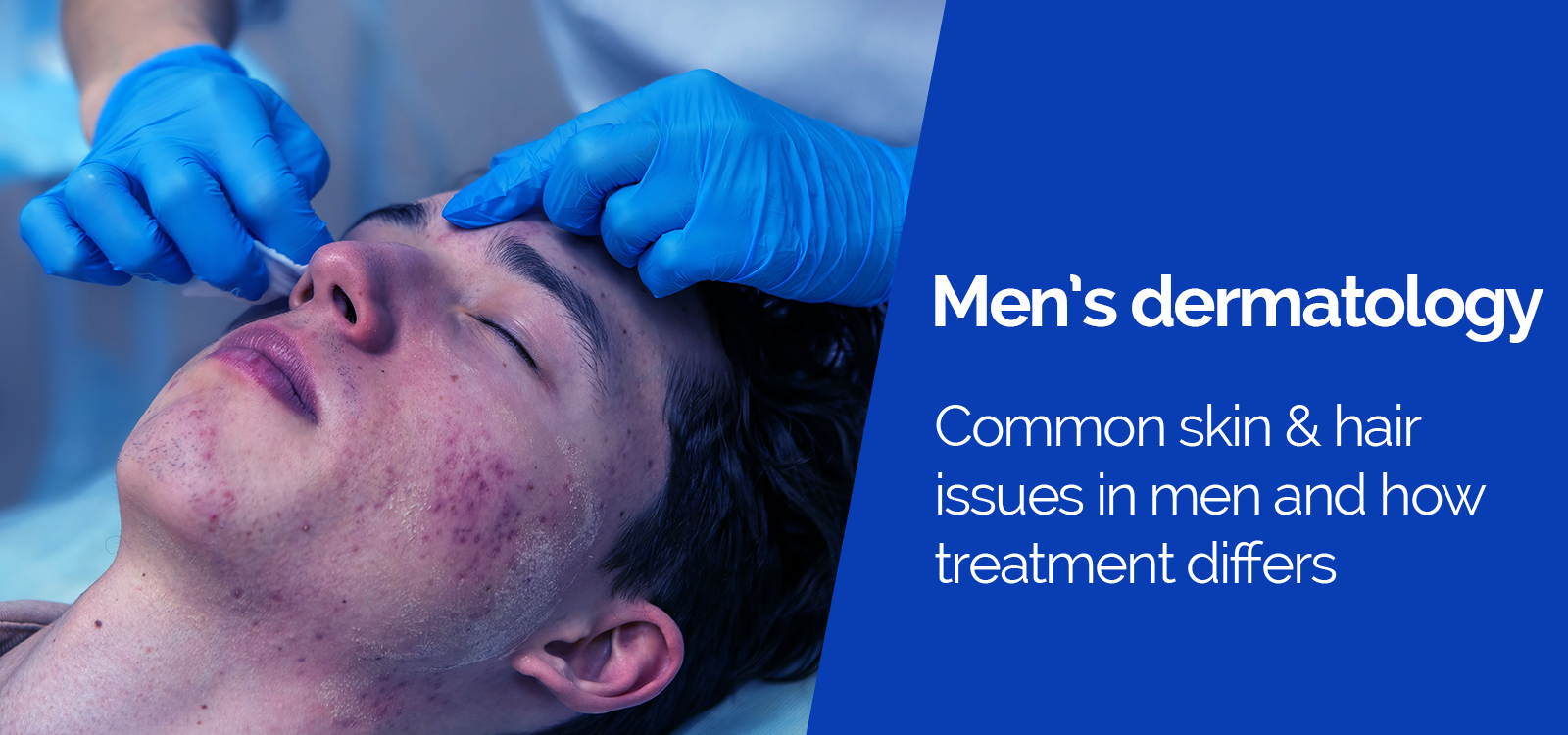 Men’s Dermatology. Common Skin and Hair Issues in Men and How Treatment Differs