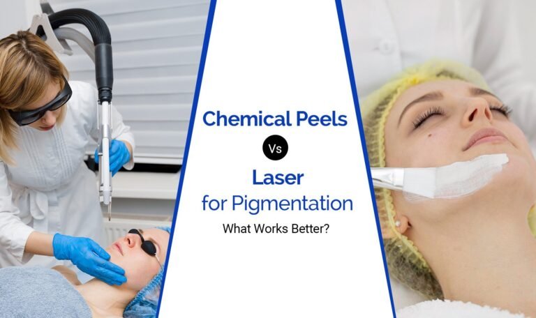 Chemical Peels vs Laser for Pigmentation. What Works Better