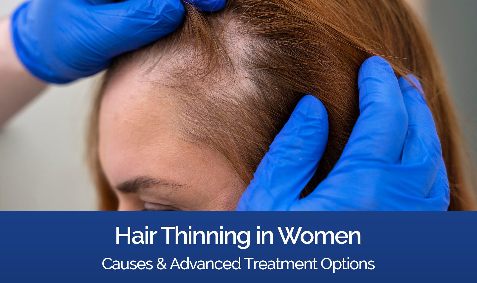 Hair thinning treatment for women