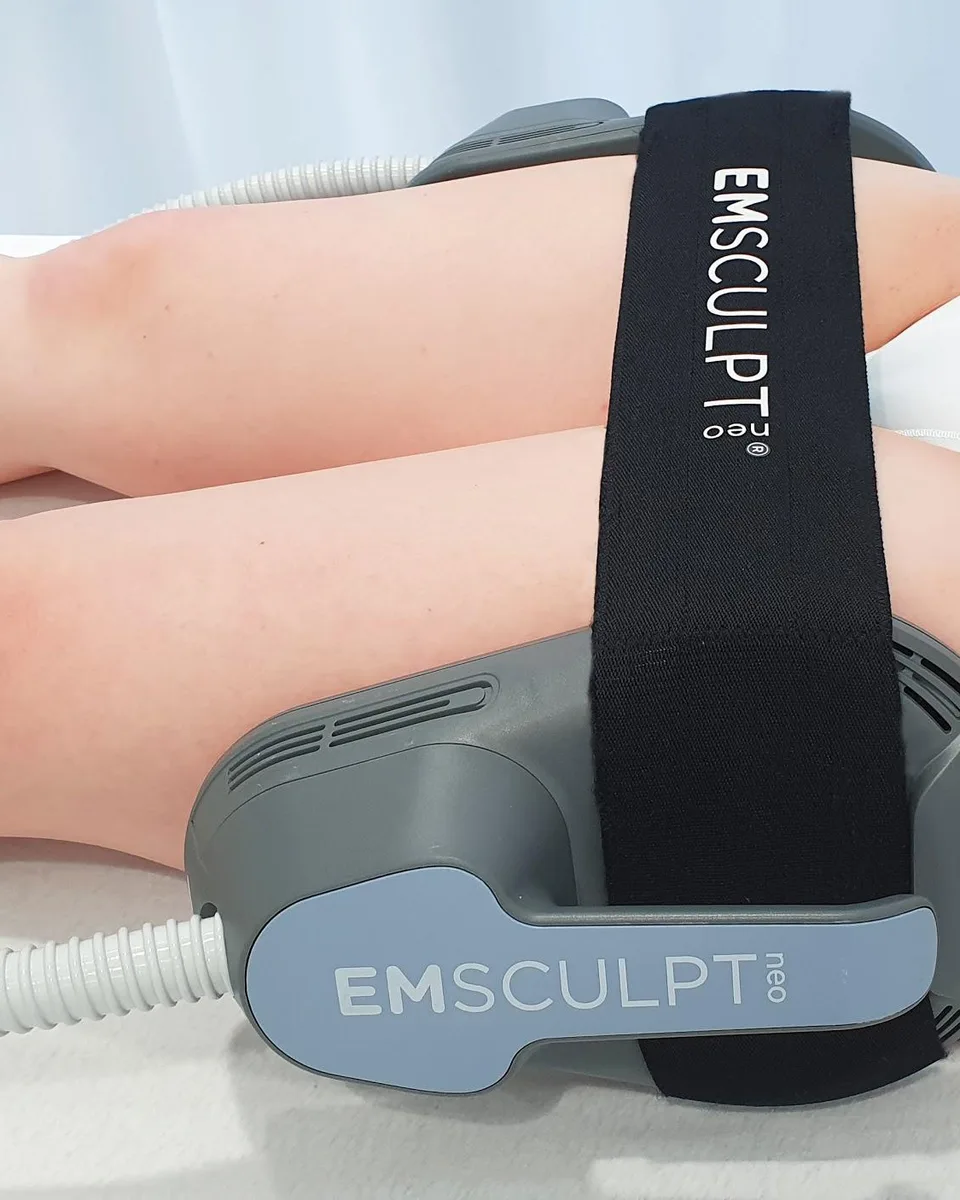 Two Emsculpt NEO applicators by BTL strapped around the thigh for muscle strengthening
