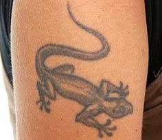 Before Tattoo Removal