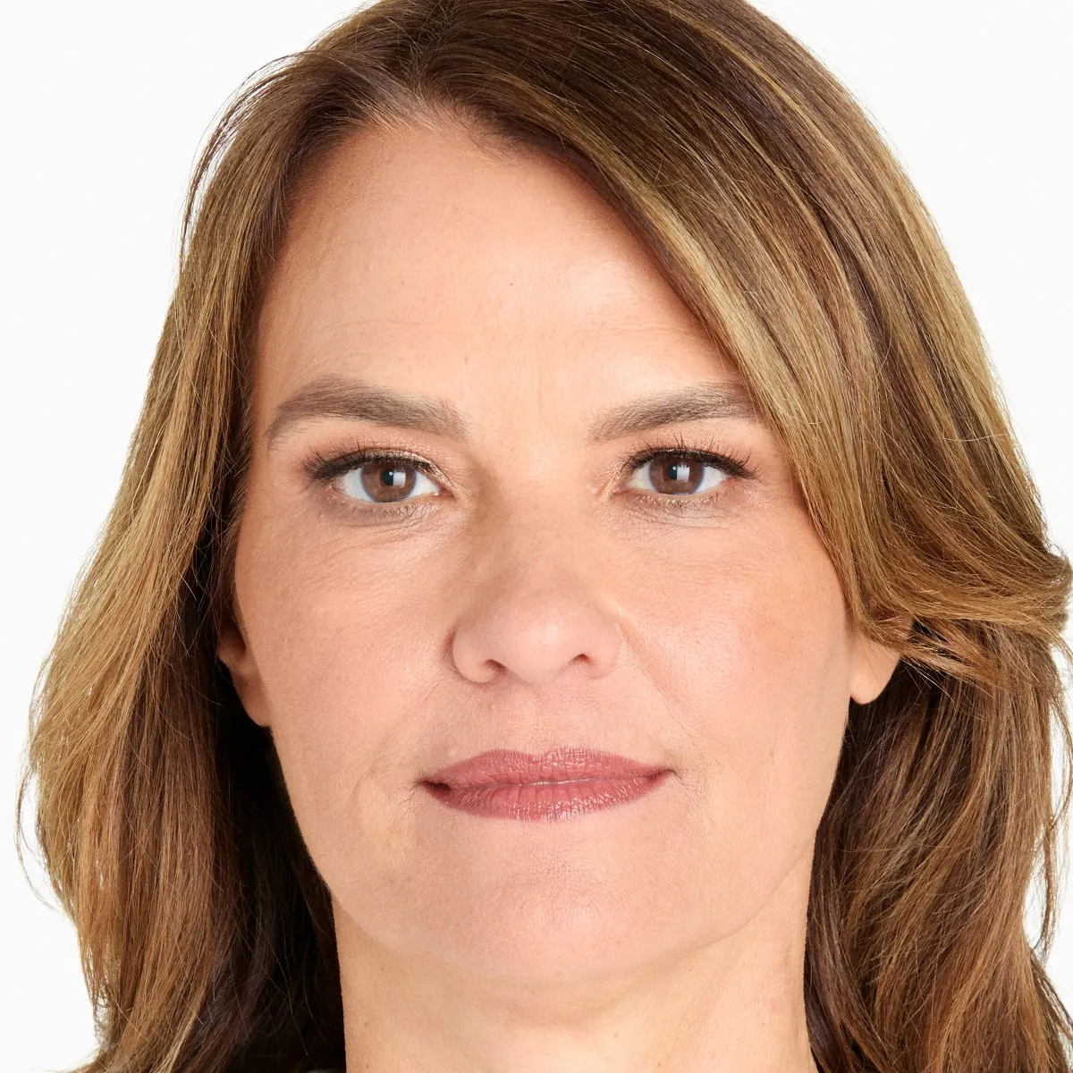 After Ultherapy · Lower face and jawline