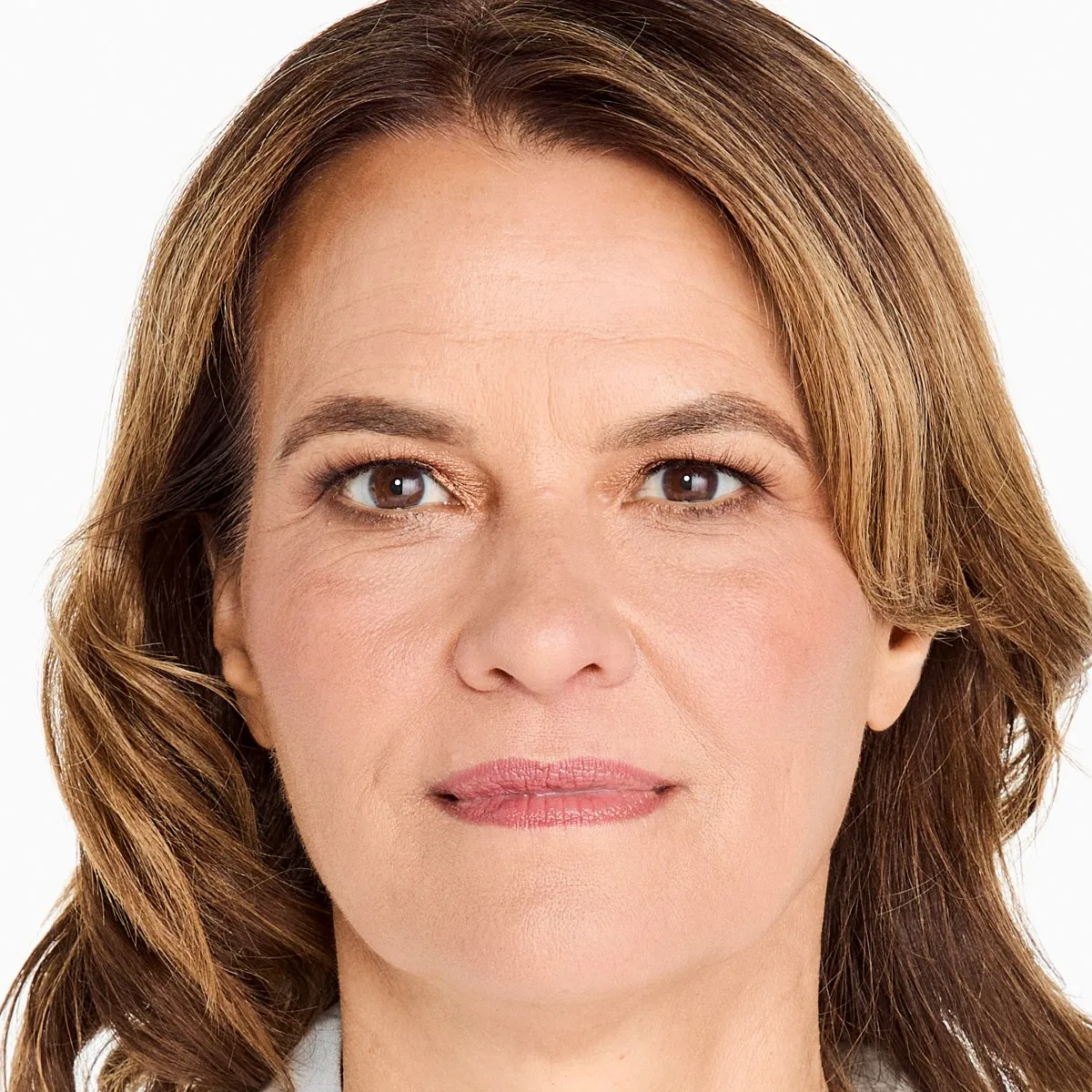 Before Ultherapy · Lower face and jawline